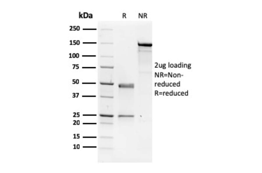 SDS-PAGE - Anti-NME1 Antibody [CPTC-NME1-2] - BSA and Azide free (A252702) - Antibodies.com