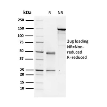 SDS-PAGE - Anti-NME1 Antibody [CPTC-NME1-2] - BSA and Azide free (A252702) - Antibodies.com