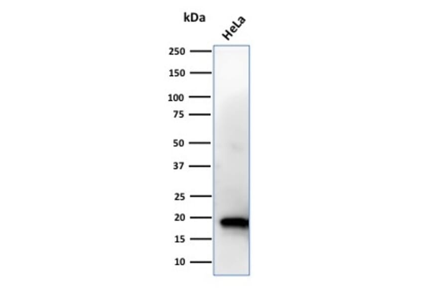 Western Blot - Anti-NME1 Antibody [CPTC-NME1-2] - BSA and Azide free (A252703) - Antibodies.com