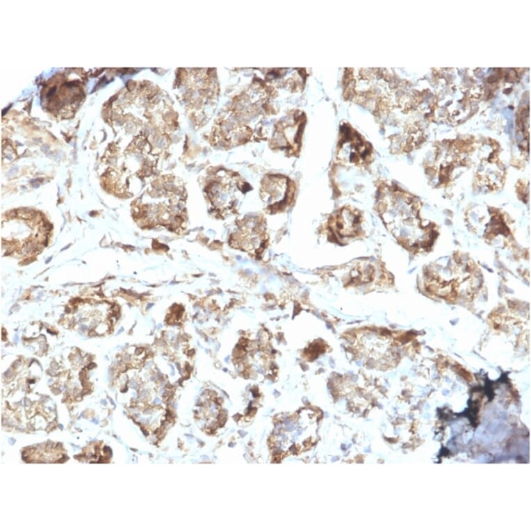 Immunohistochemistry - Anti-NME2 Antibody [CPTC-NME2-2] - BSA and Azide free (A252704) - Antibodies.com