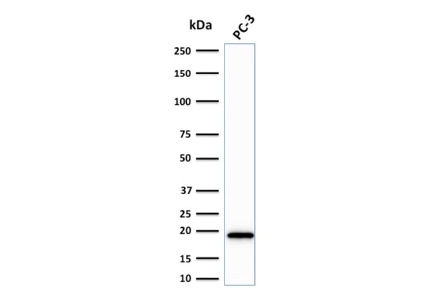 Western Blot - Anti-NME2 Antibody [CPTC-NME2-2] - BSA and Azide free (A252704) - Antibodies.com