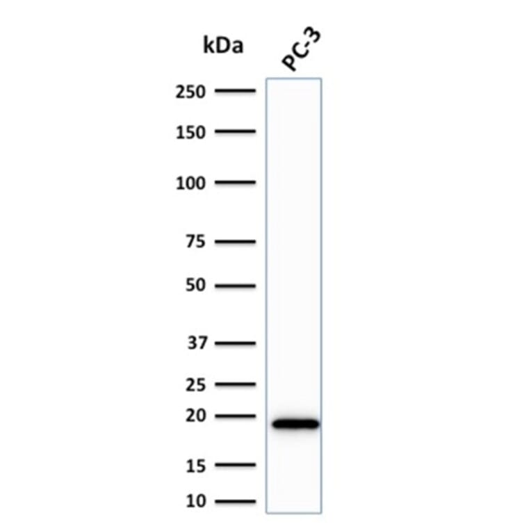 Western Blot - Anti-NME2 Antibody [CPTC-NME2-2] - BSA and Azide free (A252704) - Antibodies.com