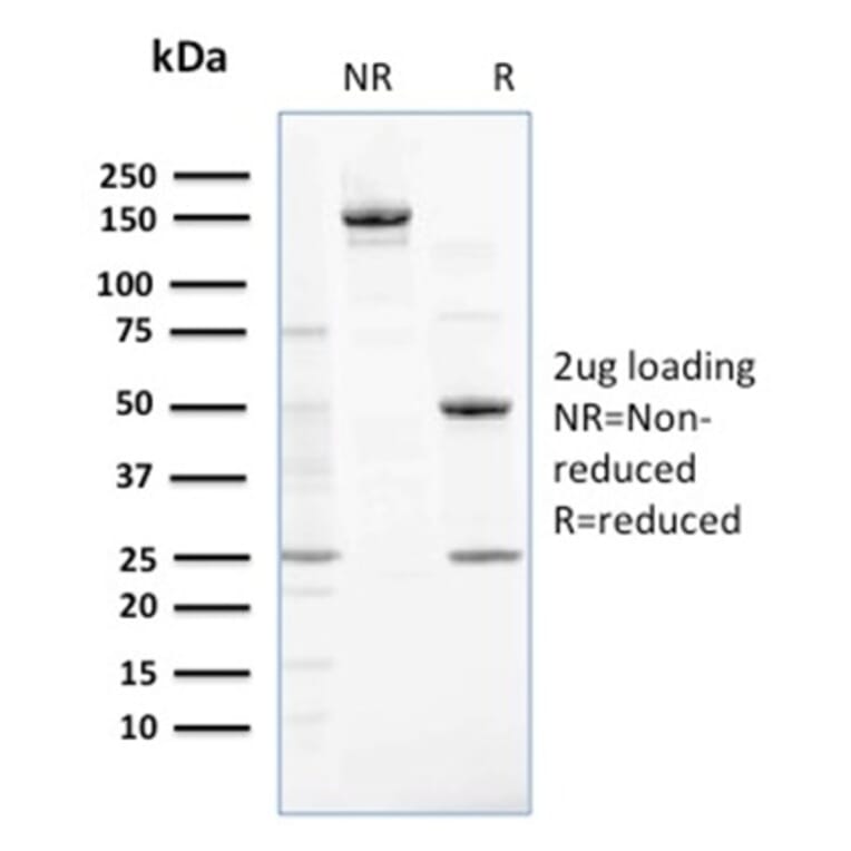 SDS-PAGE - Anti-NME2 Antibody [CPTC-NME2-2] - BSA and Azide free (A252704) - Antibodies.com