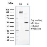 SDS-PAGE - Anti-NME2 Antibody [CPTC-NME2-2] - BSA and Azide free (A252704) - Antibodies.com