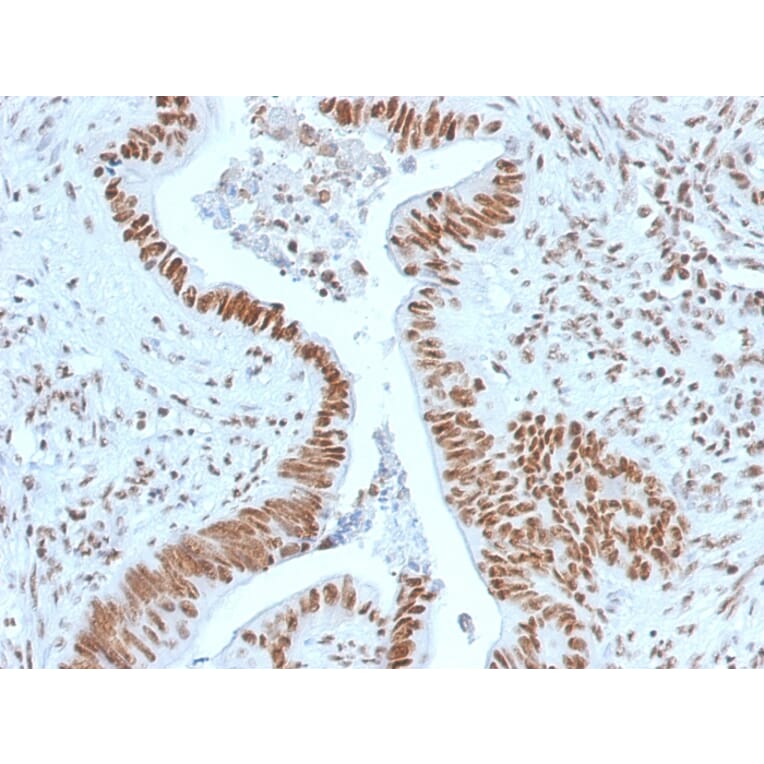 Immunohistochemistry - Anti-Nucleophosmin Antibody [NPM1/1902] - BSA and Azide free (A252705) - Antibodies.com