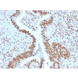 Immunohistochemistry - Anti-Nucleophosmin Antibody [NPM1/1902] - BSA and Azide free (A252705) - Antibodies.com