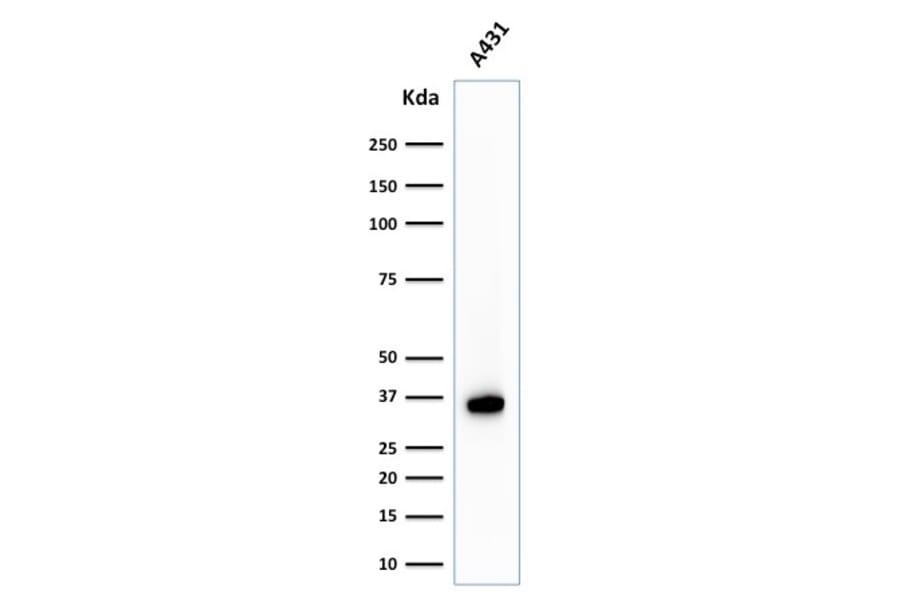Western Blot - Anti-Nucleophosmin Antibody [NPM1/1902] - BSA and Azide free (A252705) - Antibodies.com