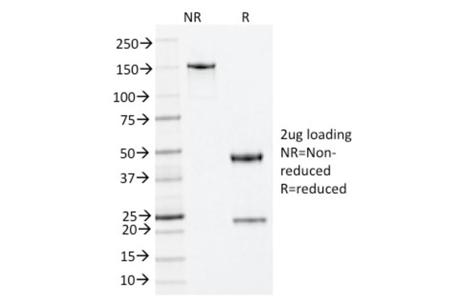 SDS-PAGE - Anti-Nucleophosmin Antibody [NA24] - BSA and Azide free (A252706) - Antibodies.com
