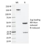 SDS-PAGE - Anti-Nucleophosmin Antibody [NA24] - BSA and Azide free (A252706) - Antibodies.com