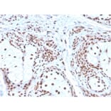 Immunohistochemistry - Anti-Nucleophosmin Antibody [NPM1/3286] - BSA and Azide free (A252708) - Antibodies.com