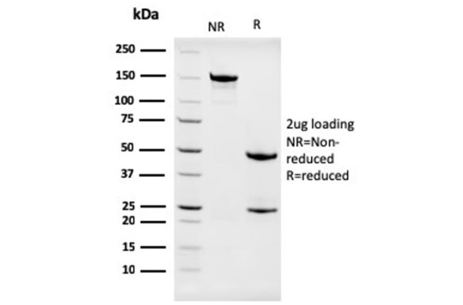 SDS-PAGE - Anti-Nucleophosmin Antibody [NPM1/3286] - BSA and Azide free (A252708) - Antibodies.com
