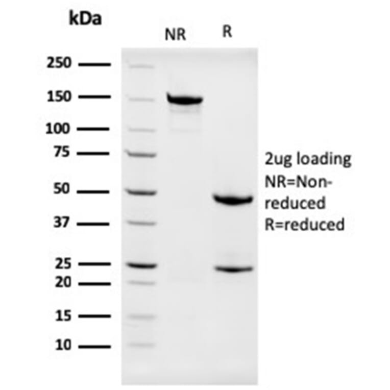 SDS-PAGE - Anti-Nucleophosmin Antibody [NPM1/3286] - BSA and Azide free (A252708) - Antibodies.com