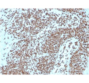 Immunohistochemistry - Anti-Nucleophosmin Antibody [NPM1/3287] - BSA and Azide free (A252709) - Antibodies.com