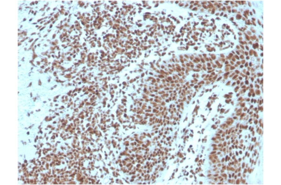 Immunohistochemistry - Anti-Nucleophosmin Antibody [NPM1/3287] - BSA and Azide free (A252709) - Antibodies.com