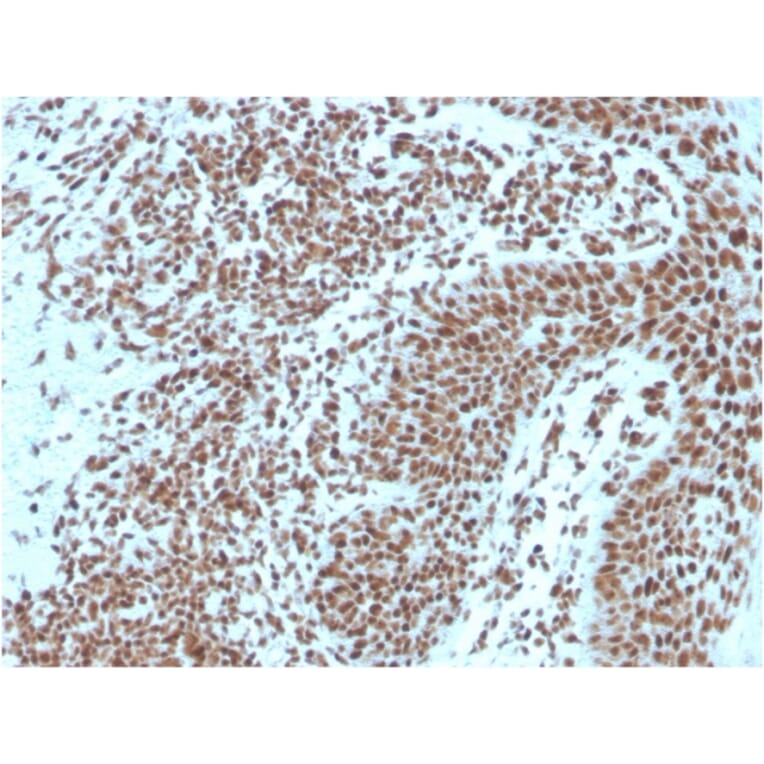 Immunohistochemistry - Anti-Nucleophosmin Antibody [NPM1/3287] - BSA and Azide free (A252709) - Antibodies.com