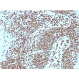 Immunohistochemistry - Anti-Nucleophosmin Antibody [NPM1/3287] - BSA and Azide free (A252709) - Antibodies.com