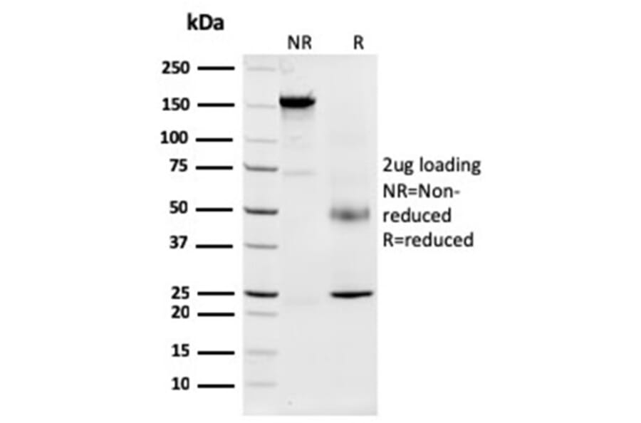 SDS-PAGE - Anti-Nucleophosmin Antibody [NPM1/3287] - BSA and Azide free (A252709) - Antibodies.com