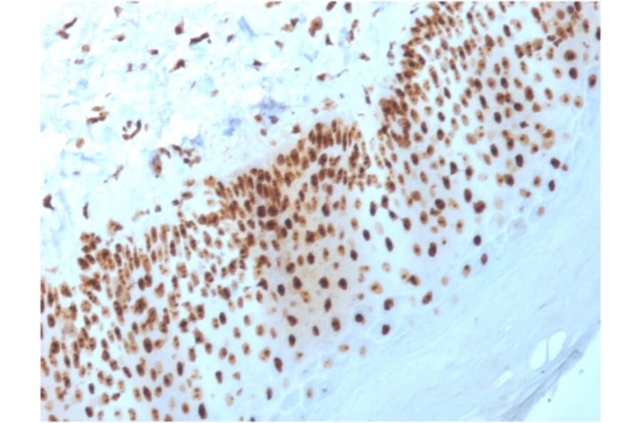 Immunohistochemistry - Anti-Nucleophosmin Antibody [NPM1/3398] - BSA and Azide free (A252710) - Antibodies.com