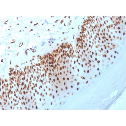 Immunohistochemistry - Anti-Nucleophosmin Antibody [NPM1/3398] - BSA and Azide free (A252710) - Antibodies.com