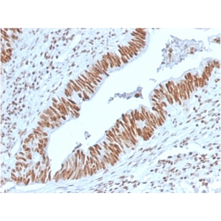 Immunohistochemistry - Anti-Nucleophosmin Antibody [NPM1/3398] - BSA and Azide free (A252710) - Antibodies.com