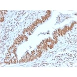 Immunohistochemistry - Anti-Nucleophosmin Antibody [NPM1/3398] - BSA and Azide free (A252710) - Antibodies.com