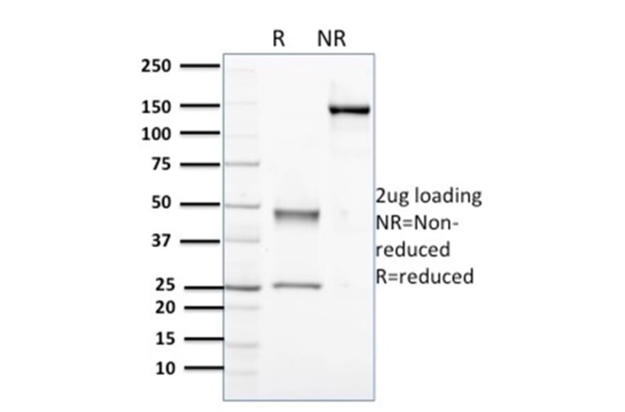 SDS-PAGE - Anti-Nucleophosmin Antibody [NPM1/3398] - BSA and Azide free (A252710) - Antibodies.com
