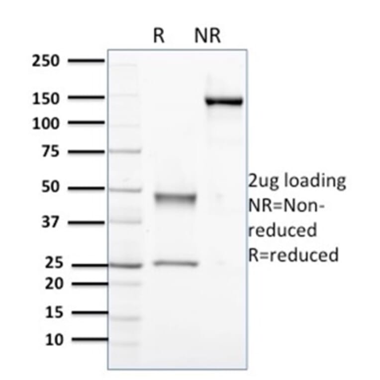 SDS-PAGE - Anti-Nucleophosmin Antibody [NPM1/3398] - BSA and Azide free (A252710) - Antibodies.com