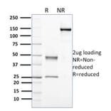 SDS-PAGE - Anti-Nucleophosmin Antibody [NPM1/3398] - BSA and Azide free (A252710) - Antibodies.com