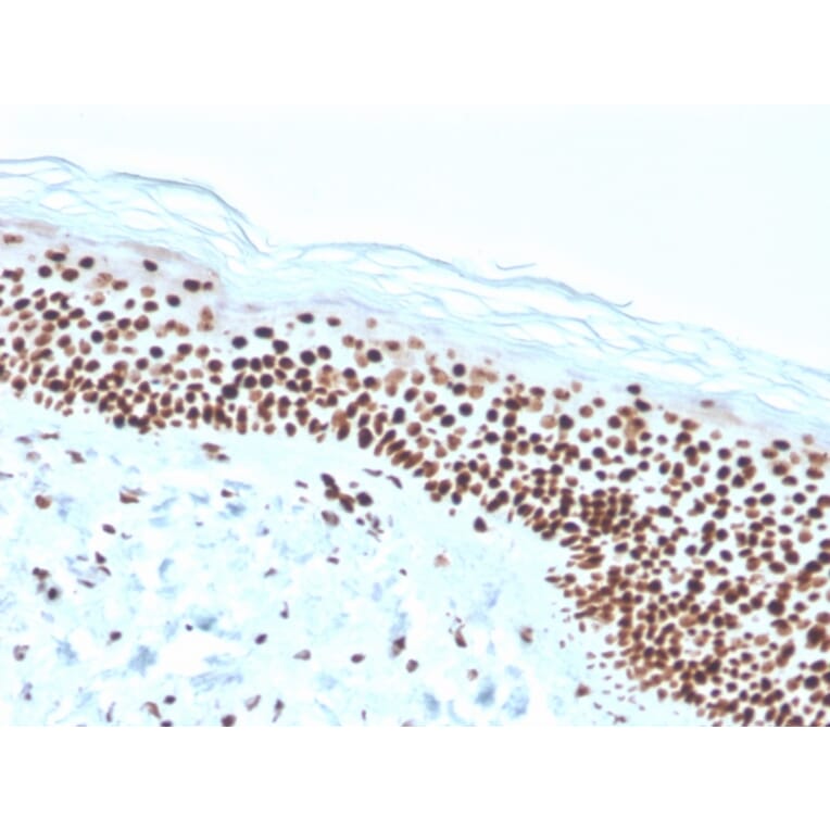 Immunohistochemistry - Anti-Nucleophosmin Antibody [rNPM1/1901] - BSA and Azide free (A252711) - Antibodies.com