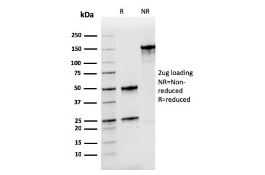 SDS-PAGE - Anti-Nucleophosmin Antibody [rNPM1/1901] - BSA and Azide free (A252711) - Antibodies.com