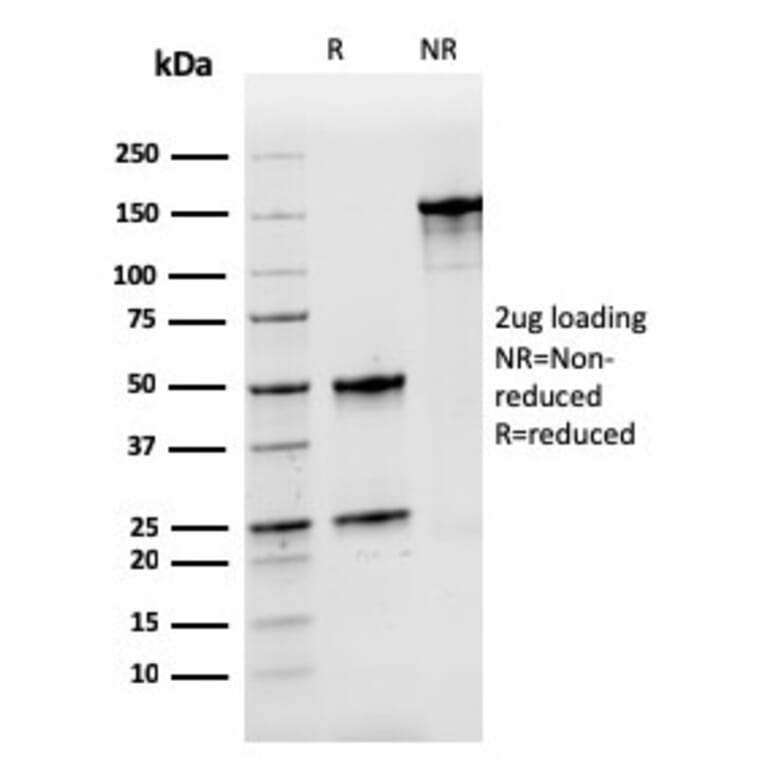 SDS-PAGE - Anti-Nucleophosmin Antibody [rNPM1/1901] - BSA and Azide free (A252711) - Antibodies.com