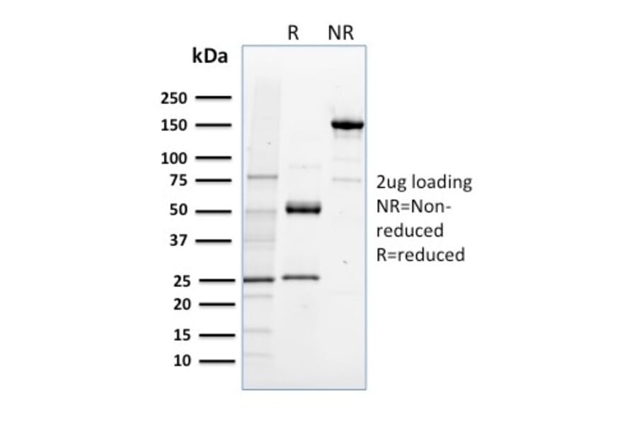 SDS-PAGE - Anti-NRF1 Antibody [NRF1/2608] - BSA and Azide free (A252712) - Antibodies.com