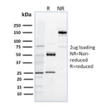 SDS-PAGE - Anti-NRF1 Antibody [NRF1/2608] - BSA and Azide free (A252712) - Antibodies.com