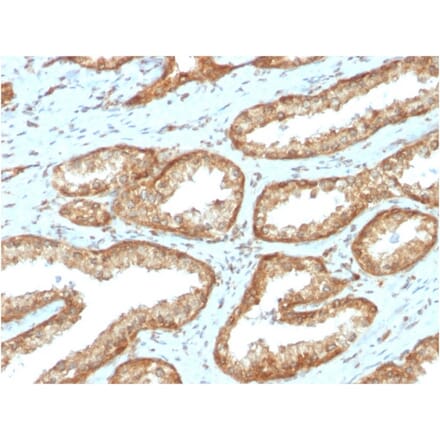 Immunohistochemistry - Anti-YB1 Antibody [YBX1/2430] - BSA and Azide free (A252714) - Antibodies.com