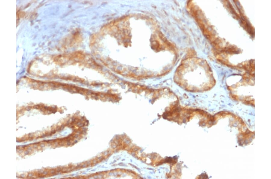 Immunohistochemistry - Anti-YB1 Antibody [rYBX1/2430] - BSA and Azide free (A252714) - Antibodies.com
