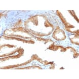 Immunohistochemistry - Anti-YB1 Antibody [rYBX1/2430] - BSA and Azide free (A252714) - Antibodies.com