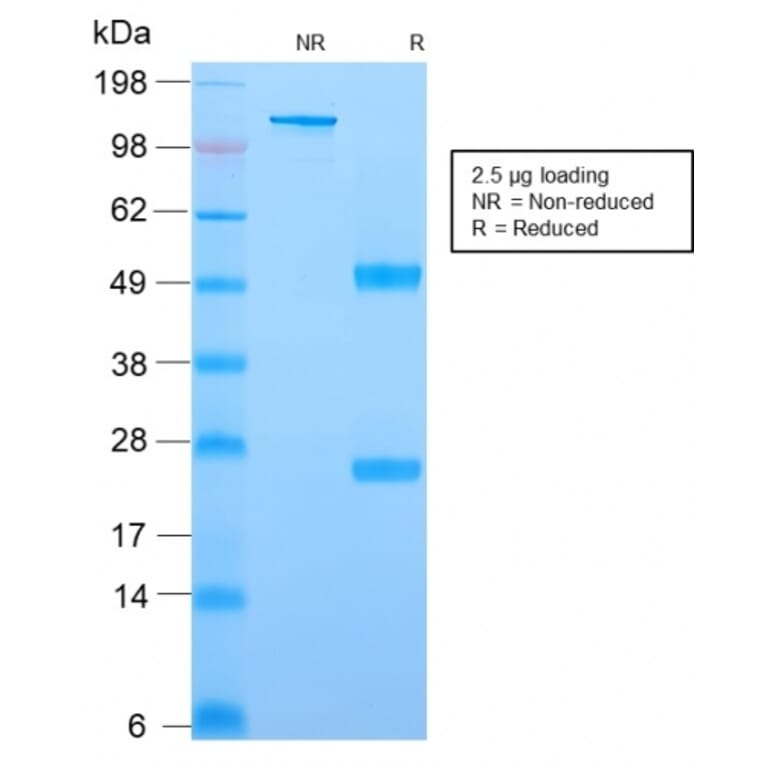 SDS-PAGE - Anti-YB1 Antibody [rYBX1/2430] - BSA and Azide free (A252715) - Antibodies.com