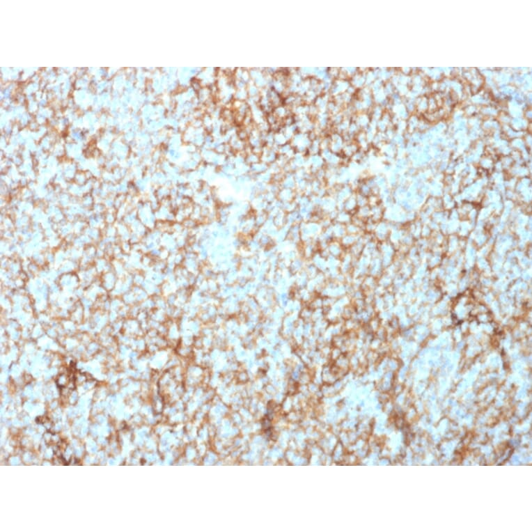 Immunohistochemistry - Anti-CD73 Antibody [NT5E/2503] - BSA and Azide free (A252716) - Antibodies.com