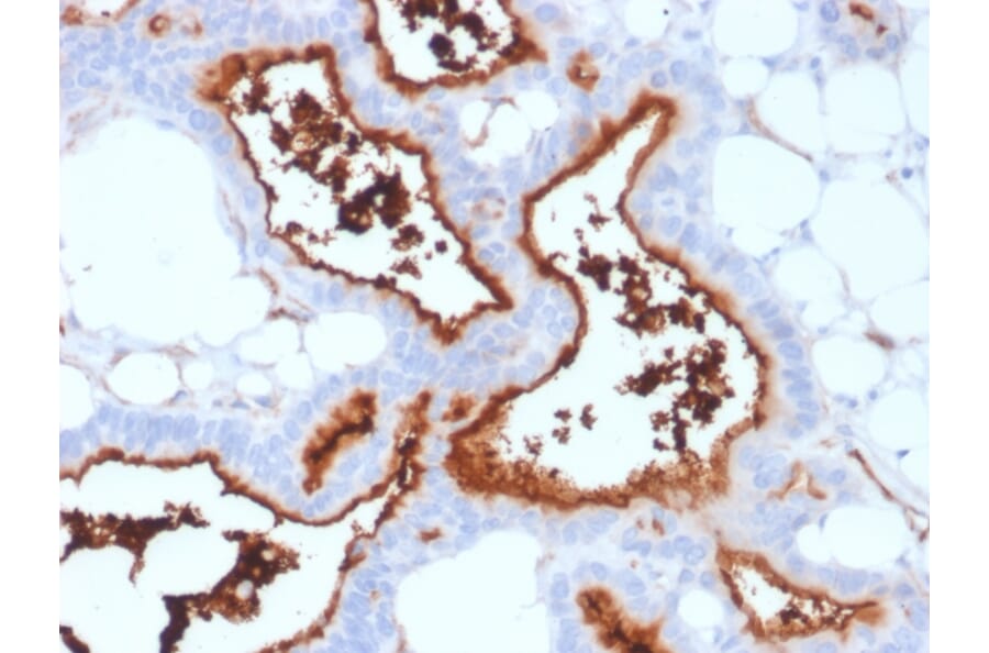 Immunohistochemistry - Anti-CD73 Antibody [NT5E/2503] - BSA and Azide free (A252716) - Antibodies.com