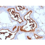 Immunohistochemistry - Anti-CD73 Antibody [NT5E/2503] - BSA and Azide free (A252716) - Antibodies.com