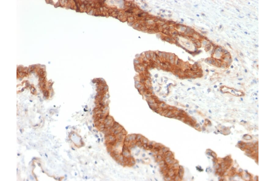 Immunohistochemistry - Anti-CD73 Antibody [NT5E/2503] - BSA and Azide free (A252716) - Antibodies.com