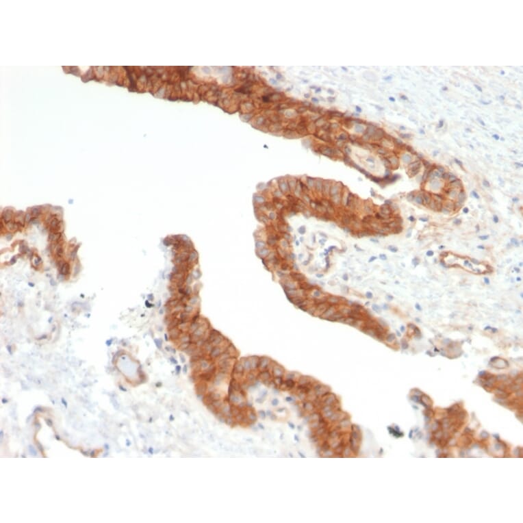 Immunohistochemistry - Anti-CD73 Antibody [NT5E/2503] - BSA and Azide free (A252716) - Antibodies.com