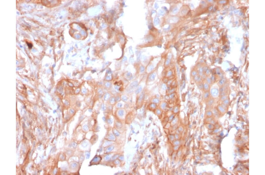 Immunohistochemistry - Anti-CD73 Antibody [NT5E/2503] - BSA and Azide free (A252716) - Antibodies.com