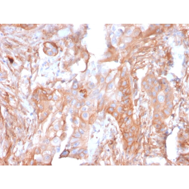 Immunohistochemistry - Anti-CD73 Antibody [NT5E/2503] - BSA and Azide free (A252716) - Antibodies.com