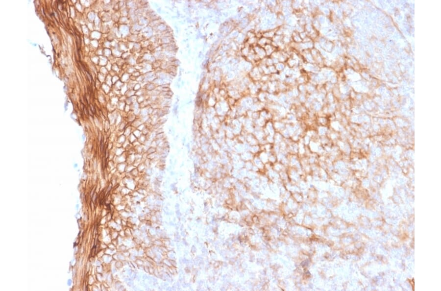 Immunohistochemistry - Anti-CD73 Antibody [NT5E/2505] - BSA and Azide free (A252717) - Antibodies.com