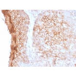 Immunohistochemistry - Anti-CD73 Antibody [NT5E/2505] - BSA and Azide free (A252717) - Antibodies.com