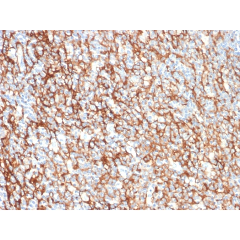 Immunohistochemistry - Anti-CD73 Antibody [NT5E/2505] - BSA and Azide free (A252717) - Antibodies.com