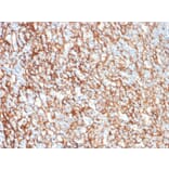 Immunohistochemistry - Anti-CD73 Antibody [NT5E/2505] - BSA and Azide free (A252717) - Antibodies.com