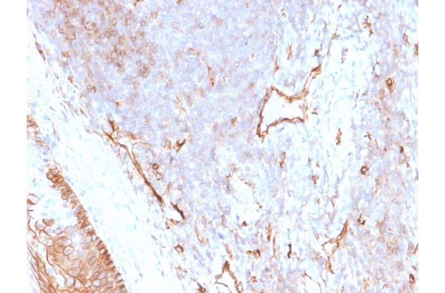 Immunohistochemistry - Anti-CD73 Antibody [NT5E/2505] - BSA and Azide free (A252717) - Antibodies.com