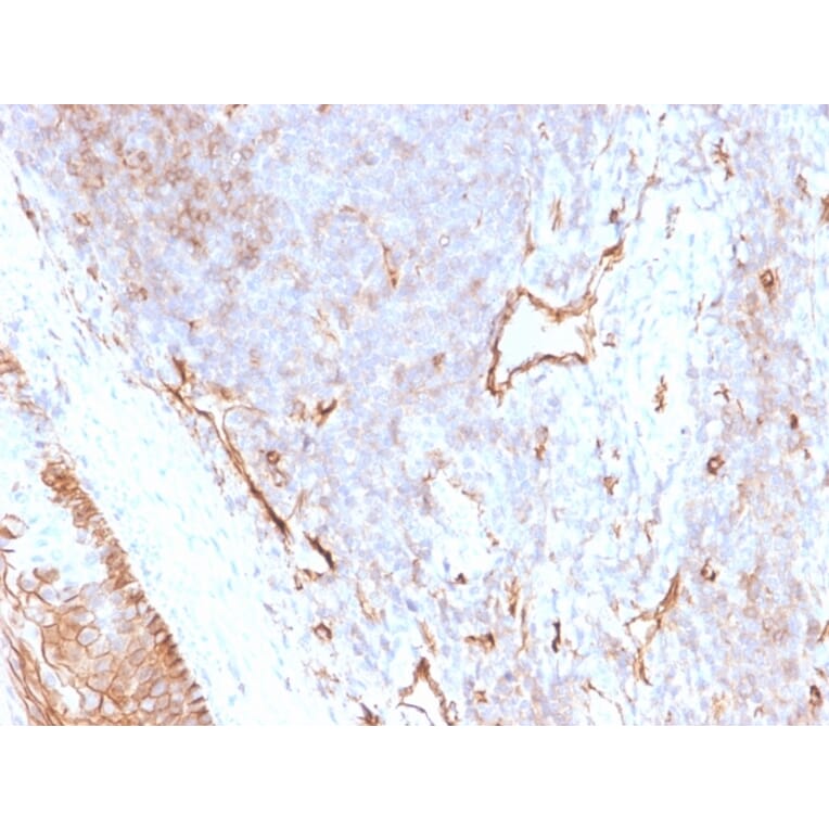 Immunohistochemistry - Anti-CD73 Antibody [NT5E/2505] - BSA and Azide free (A252717) - Antibodies.com